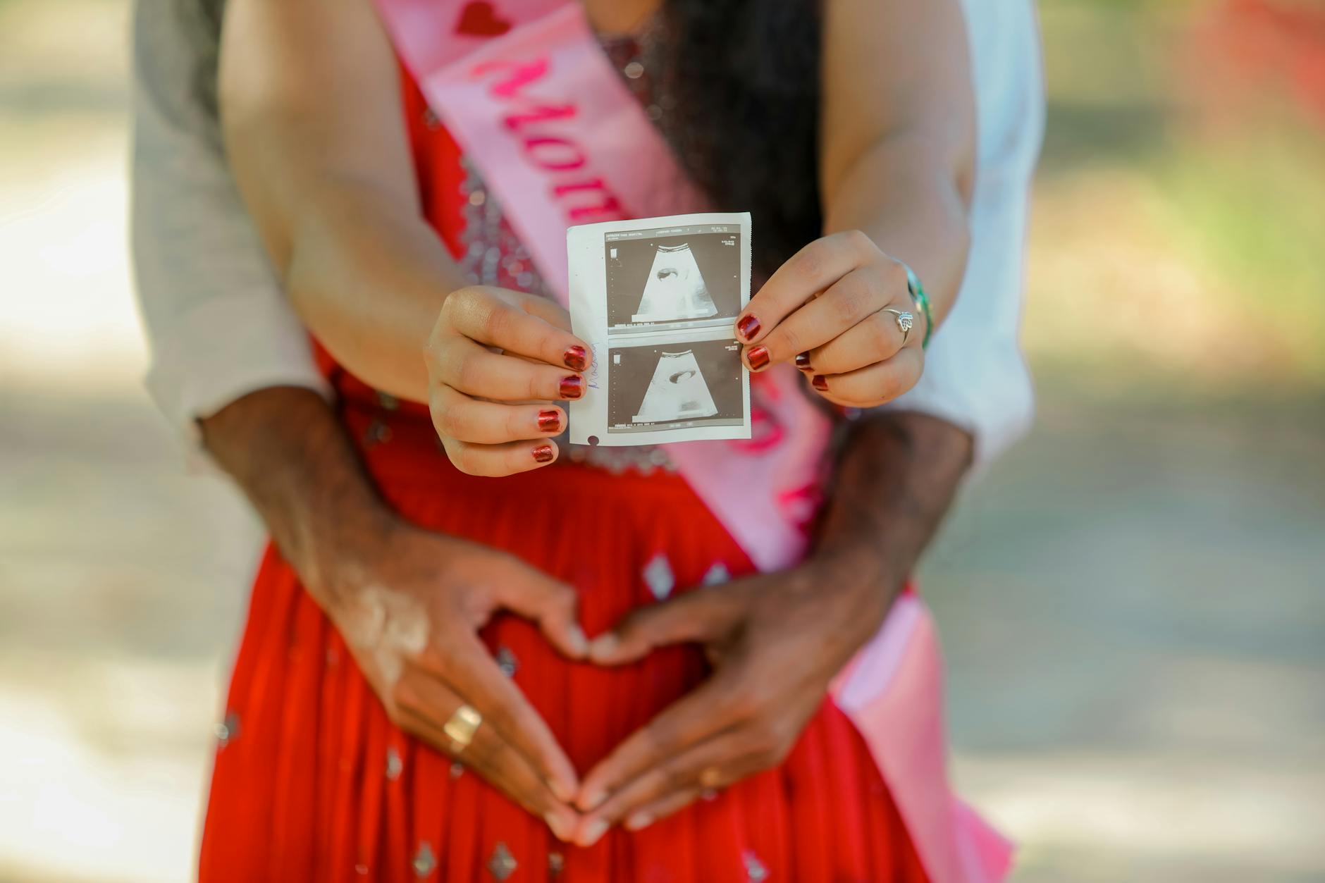 A joyful couple holding an ultrasound photo, celebrating pregnancy outdoors.